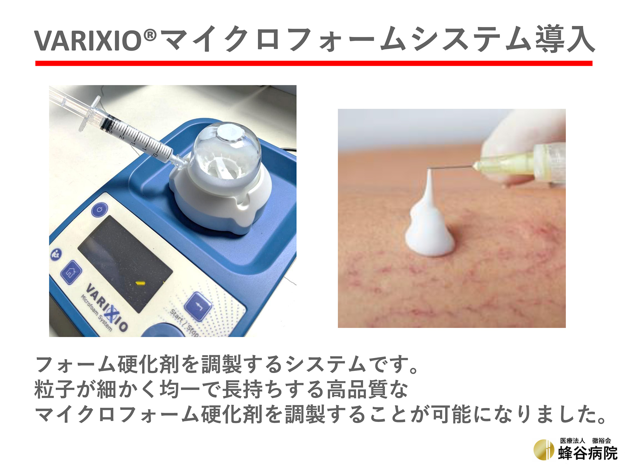 VARIXIOマイクロフォームシステム