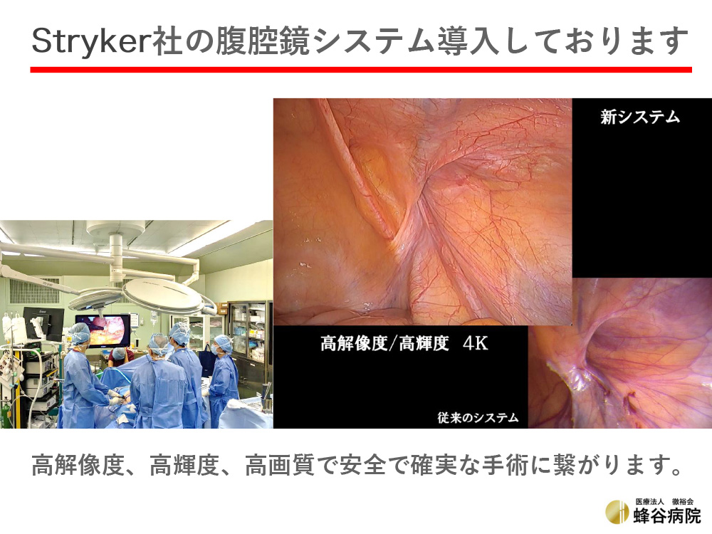 Stryker社 腹腔鏡システム