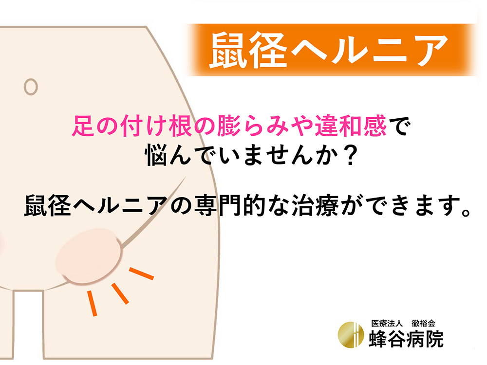 鼠径ヘルニア